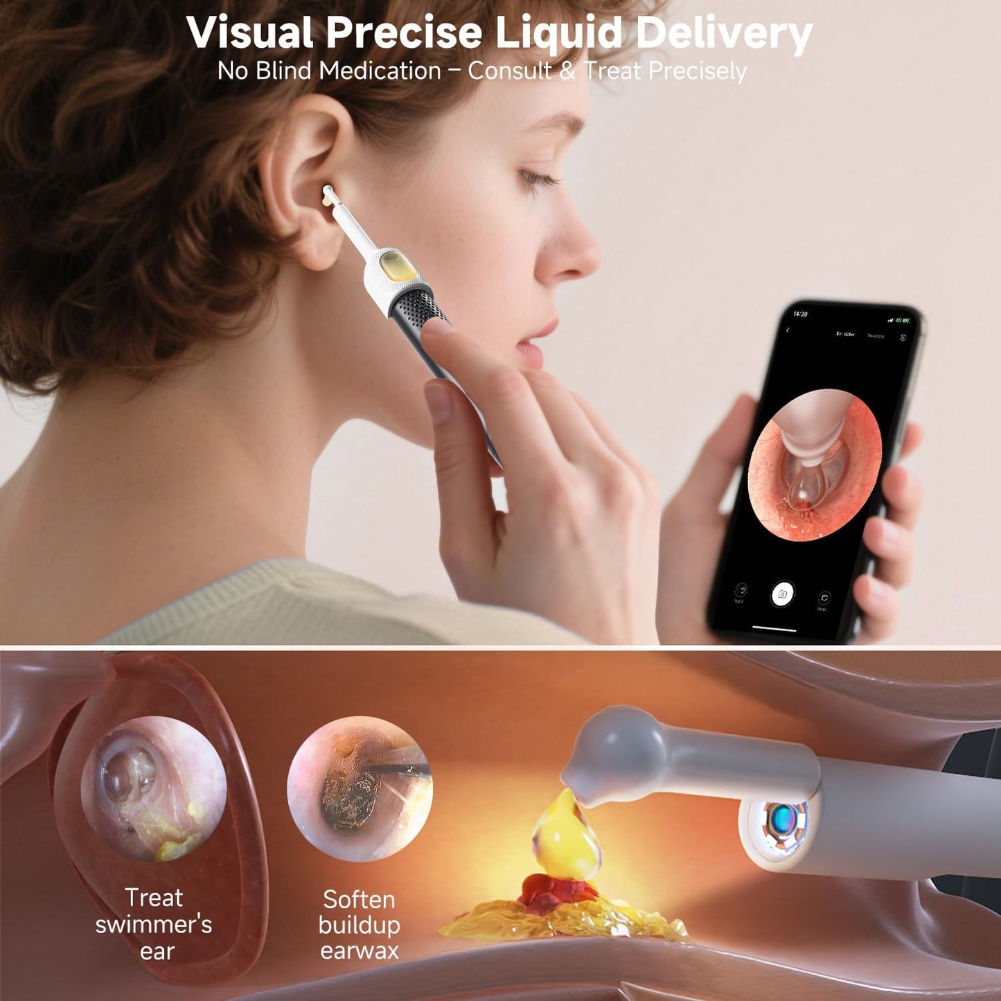 BEBIRD R1 Ultra Wireless Otoscope Ear Wax Removal Tool Camera with Tweezers