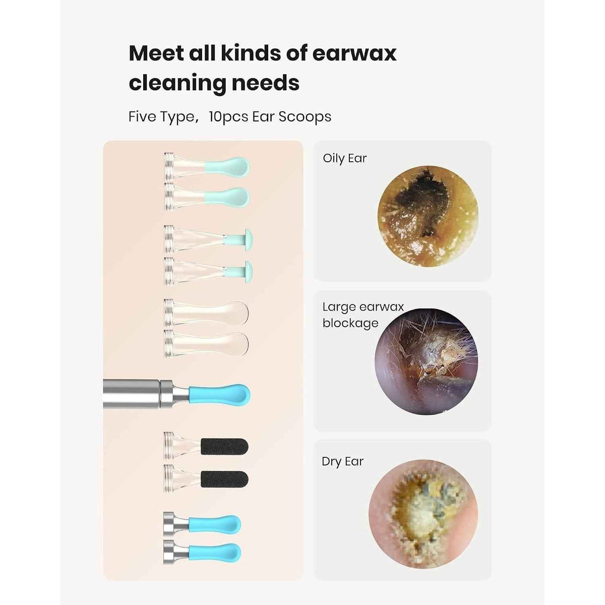 BEBIRD R1 ear wax removal kit with HD camera, showing the sleek tool and camera lens for safe ear cleaning.