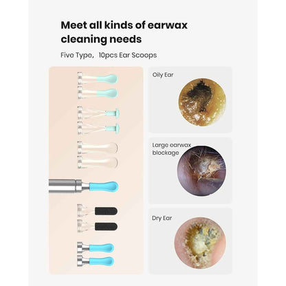 BEBIRD R1 ear wax removal kit with HD camera, showing the sleek tool and camera lens for safe ear cleaning.