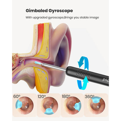 BEBIRD R1 ear wax removal kit with HD camera showing a close-up view of the tool and camera tip for ear cleaning.