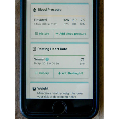 KardiaMobile 1-Lead EKG Monitor Medical-Grade FDA-Cleared Personal Heart Monitor Detects AFib & Arrhythmias 30 Second Results Works with Most Smartphones