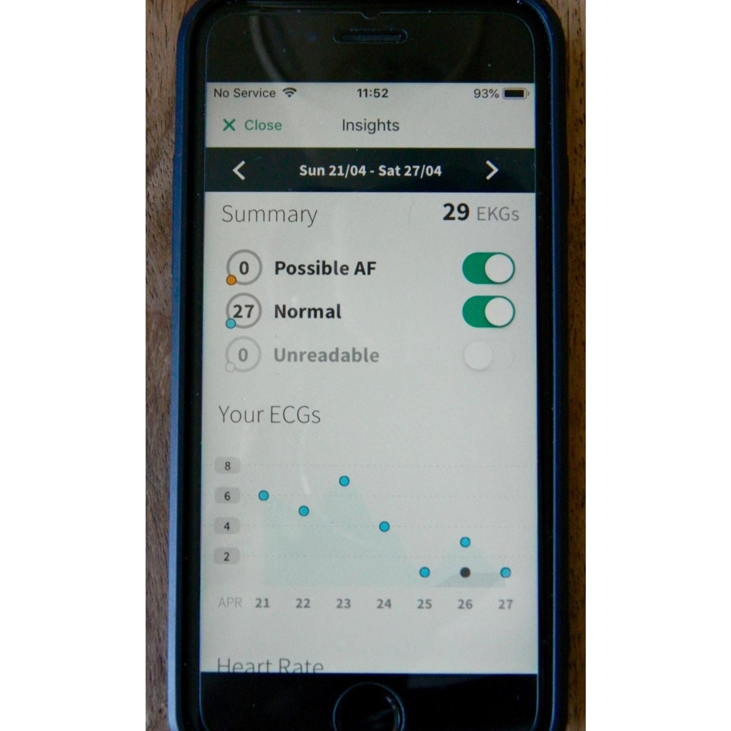 KardiaMobile 1-Lead EKG Monitor Medical-Grade FDA-Cleared Personal Heart Monitor Detects AFib & Arrhythmias 30 Second Results Works with Most Smartphones