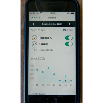 KardiaMobile 1-Lead EKG Monitor Medical-Grade FDA-Cleared Personal Heart Monitor Detects AFib & Arrhythmias 30 Second Results Works with Most Smartphones