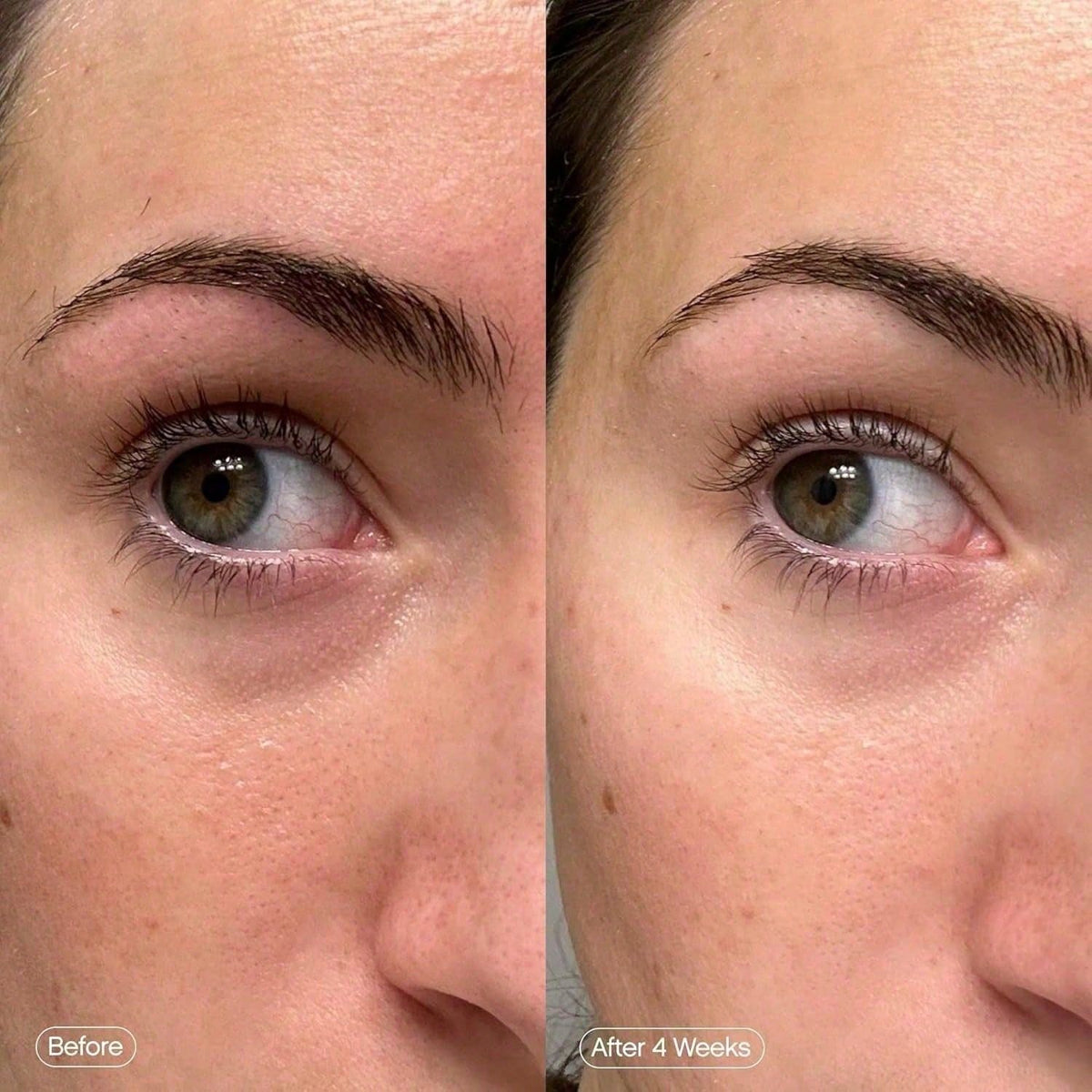 VitaBuy brightening under eye masks with kojic acid, caffeine, and niacinamide in a set of 6 for skincare treatment.