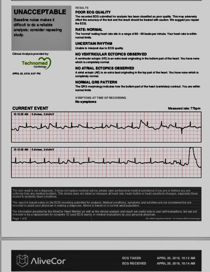 KardiaMobile 1-Lead EKG Monitor Medical-Grade FDA-Cleared Personal Heart Monitor Detects AFib & Arrhythmias 30 Second Results Works with Most Smartphones