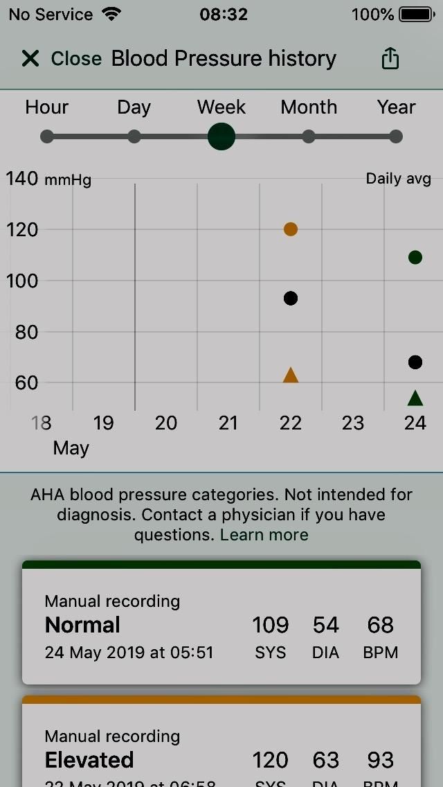 KardiaMobile 1-Lead EKG Monitor Medical-Grade FDA-Cleared Personal Heart Monitor Detects AFib & Arrhythmias 30 Second Results Works with Most Smartphones