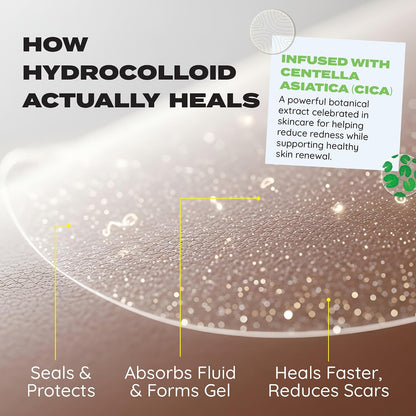 MakeItSkin SUPERBAND Bug Bite Relief Hydrocolloid Patches