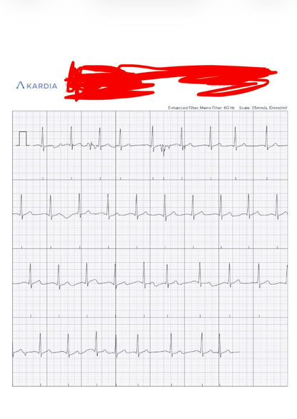 KardiaMobile 1-Lead EKG Monitor Medical-Grade FDA-Cleared Personal Heart Monitor Detects AFib & Arrhythmias 30 Second Results Works with Most Smartphones