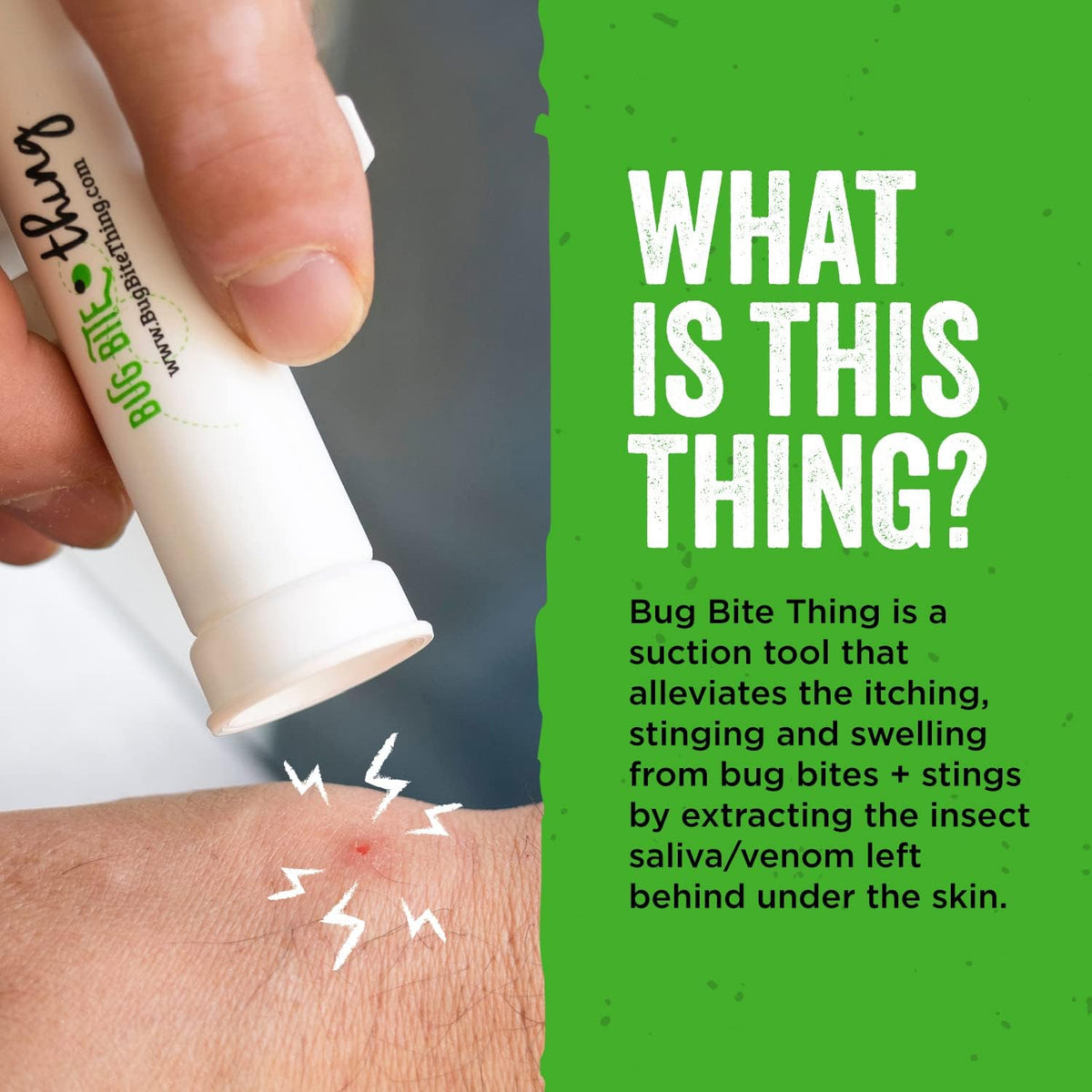 Bug Bite Thing Insect Bite Relief Suction Tool