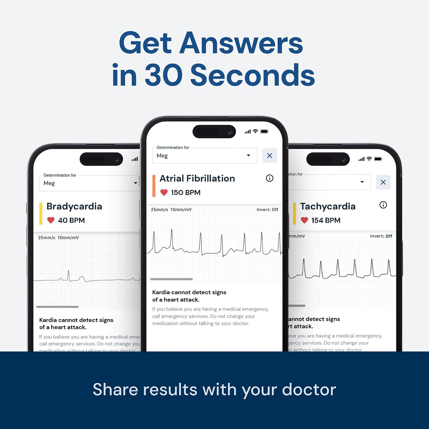 KardiaMobile 1-Lead EKG Monitor Medical-Grade FDA-Cleared Personal Heart Monitor Detects AFib & Arrhythmias 30 Second Results Works with Most Smartphones