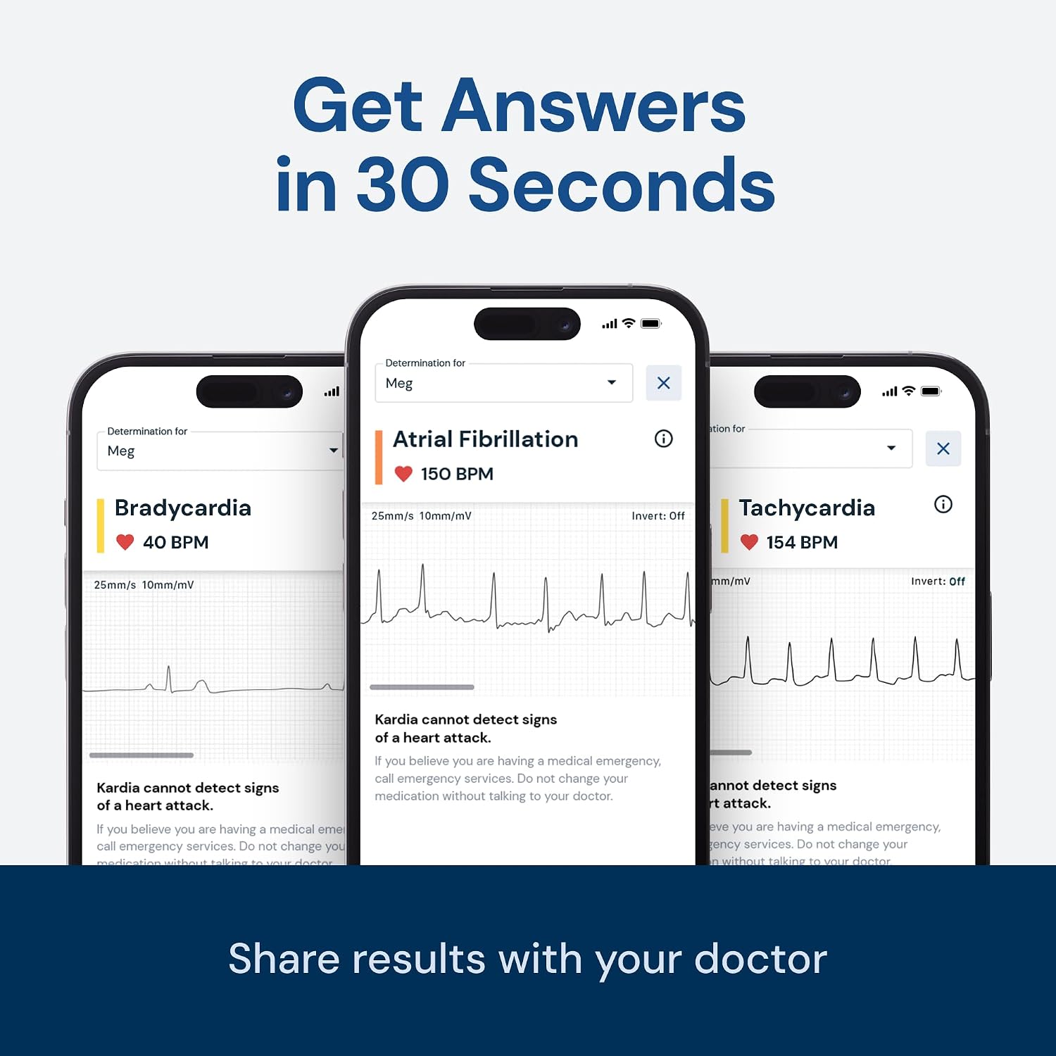 KardiaMobile 1-Lead EKG Monitor Medical-Grade FDA-Cleared Personal Heart Monitor Detects AFib & Arrhythmias 30 Second Results Works with Most Smartphones