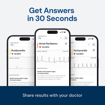 KardiaMobile 1-Lead EKG Monitor Medical-Grade FDA-Cleared Personal Heart Monitor Detects AFib & Arrhythmias 30 Second Results Works with Most Smartphones